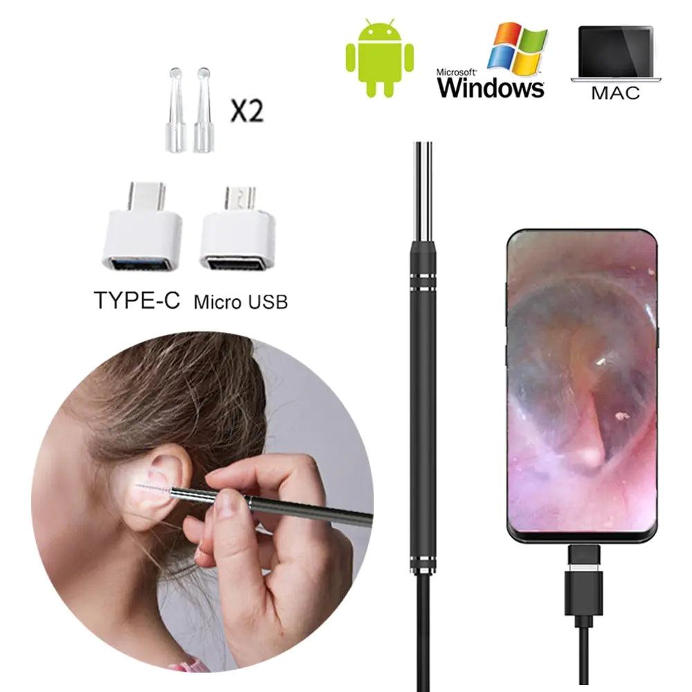 Smart Earwax Removal Tool w/ Camera - Emporium WRJJ