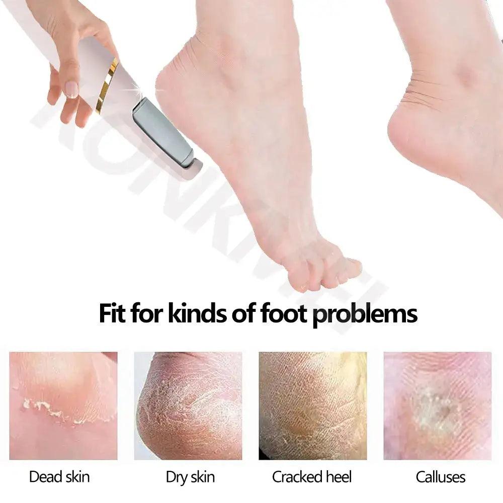 VelvetStep Foot Exfoliator - Emporium WRJJ