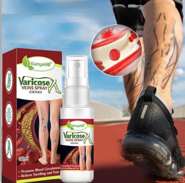 Varicose Veins Treatment Spray - Emporium WRJJ